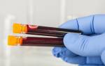 Что такое RDW в анализе крови: расшифровка и норма