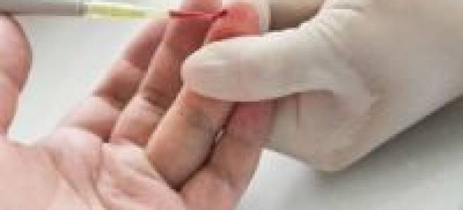 Показатели нормы в анализе крови на уровень глюкозы