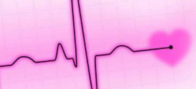 Стандартных отведений в электрокардиографии