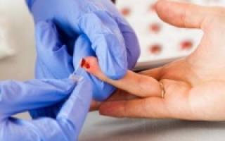 Низкий уровень тромбоцитов в крови у женщин
