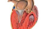 Диагноз гипертрофия левого желудочка сердца