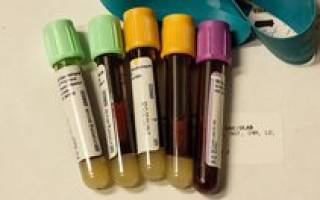 Общий анализ крови с лейкоформулой расшифровка у женщин