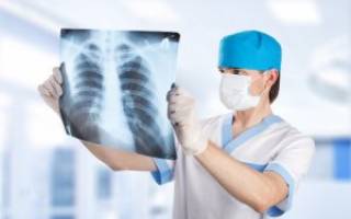 Рентген ребер и органов грудной клетки все о диагностике