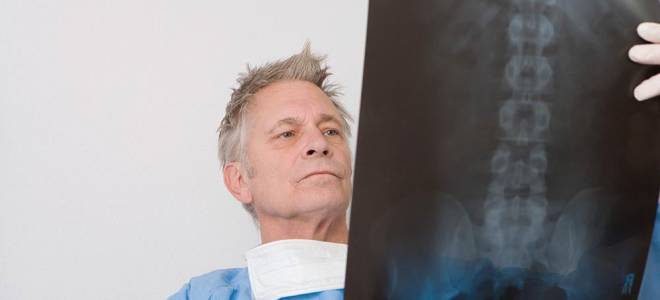 Спинальный инсульт (ишемический инсульт спинного мозга)