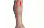 Стеноз артерий нижних конечностей