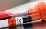 Клинический анализ крови — это… Что такое Клинический анализ крови?