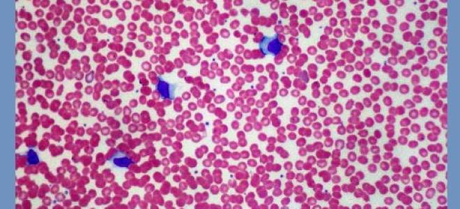 Лабораторная диагностика инфекционного лимфоцитоза — анализы