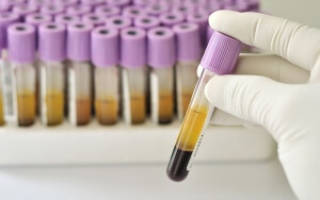 Анализ крови ПТИ: расшифровка, норма, отклонения