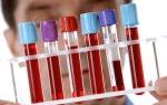 Подготовка к биохимическому анализу крови и расшифровка результатов