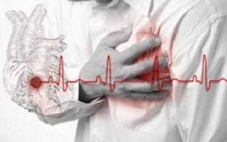 Предынфарктное состояние, признаки и симптомы предынфарктного состояния