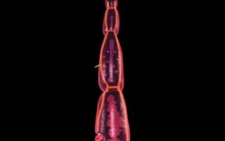 Однокамерный эхинококк пути заражения и методы удаления гельминта