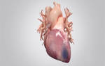Последствия инфаркта у мужчин — Сердце
