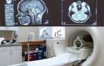 Какие осложнения и последствия может вызвать МРТ?