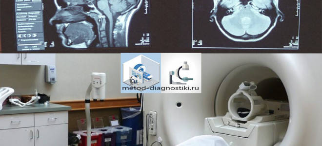Какие осложнения и последствия может вызвать МРТ?