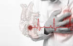 Инфаркт миокарда симптомы и последствия у мужчин после 50