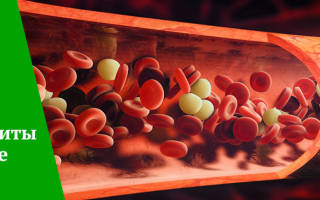 Низкие тромбоциты в крови — причины тромбоцитопении
