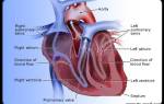 Ревматические пороки сердца терапия