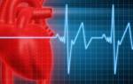 Почему бывает тахикардия ⋆ Лечение Сердца