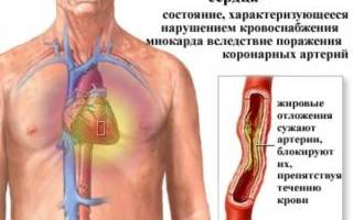 В области грудной клетки покалывание