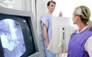 Когда и как делают рентген кишечника с барием