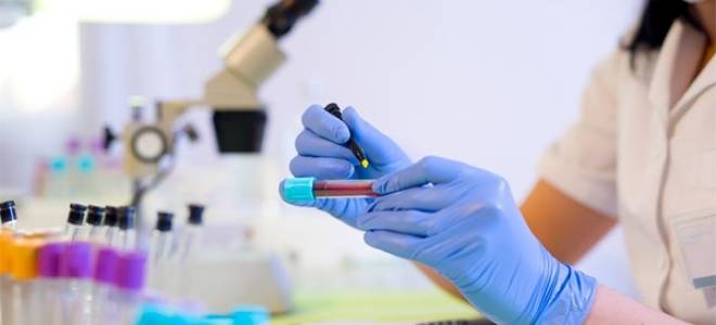 Анализы на ВИЧ: какие анализы сдают и как проводят диагностику ВИЧ и СПИД?