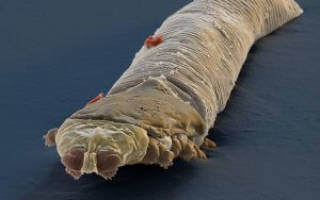 Анализ на подкожного клеща и лечение демодекоза