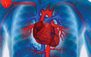 Ослабление сердечной мышцы причины и лечение