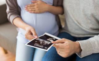 Узи на разных сроках беременности по триместрам