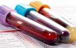 Как правильно сдавать кровь на ревматоидный фактор и о чем может рассказать анализ