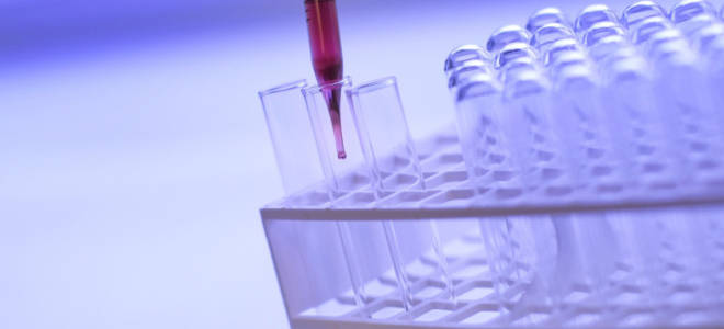 Нормы СОЭ для женщин по возрасту (таблица)