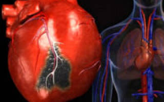 Что значит увеличен левый желудочек сердца