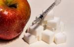 Сахарный диабет 1 типа — это… Что такое Сахарный диабет 1 типа?