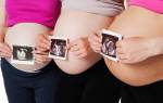 Третье УЗИ при беременности нормы обследования в таблицах
