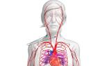 Извитость позвоночных артерий симптомы и лечение