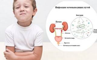 Цистит у детей — лечение, симптомы и признаки