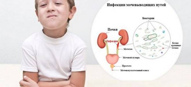 Цистит у детей — лечение, симптомы и признаки
