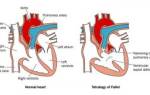 Нарушение диастолической функции миокарда обоих желудочков