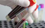 Анализ крови на КФК – что это за анализ и о чем он может рассказать?