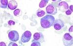 Плазматические клетки повышены в общем анализе крови у ребенка
