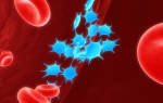 Анализ крови: тромбоциты повышены — что это значит?