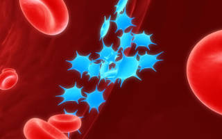 Анализ крови: тромбоциты повышены — что это значит?