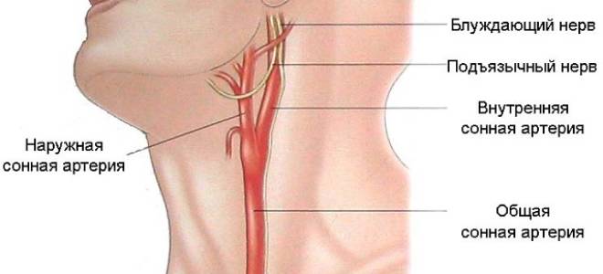 Сонная артерия на шее пережать
