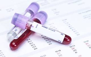 Как называется анализ на аллергию по крови?