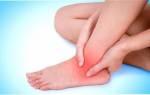 Вывих ноги – симптомы и что делать для лечения травмы