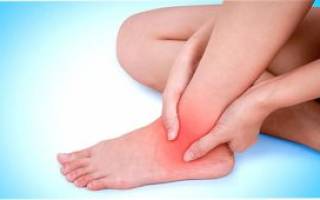 Вывих ноги – симптомы и что делать для лечения травмы