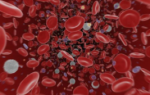Почему в крови мало лимфоцитов