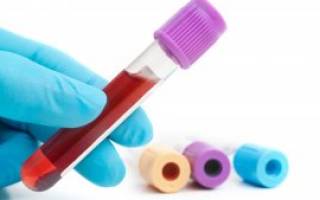 Анализ крови на ХГЧ норма у небеременных женщин