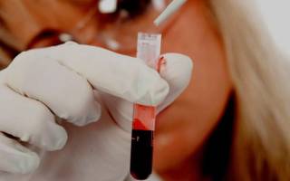 Норма общего и биохимического анализа крови у женщин