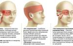 Пульсирующая боль в правой части головы – причины и лечение