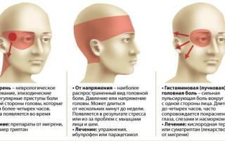 Пульсирующая боль в правой части головы – причины и лечение